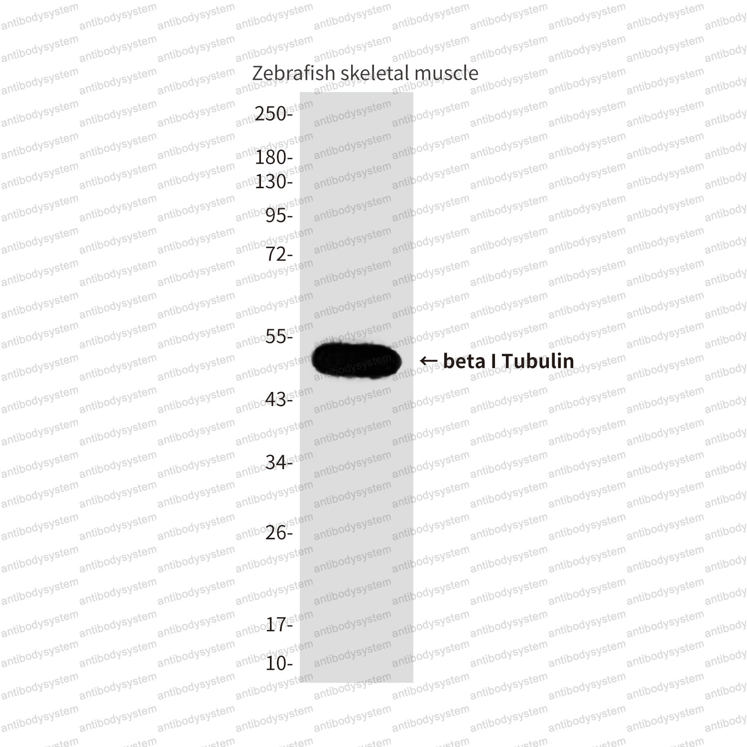 Anti-TUBB1/beta I Tubulin Antibody (R3W53)