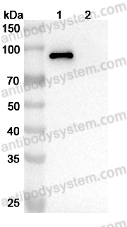 Anti-Bacillus anthracis PA/pagA/PA-83 Antibody (SAA1377)