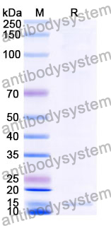 Anti-Clostridium botulinum botA/BOTOX Nanobody (SAA0929)