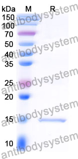 Anti-Clostridium botulinum botA/BOTOX Nanobody (SAA0936)