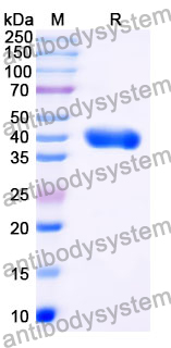 Anti-Clostridium botulinum botA/BOTOX Antibody (H7)