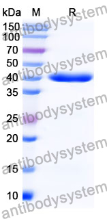 Anti-Clostridium botulinum botA/BOTOX Antibody (Aa1)