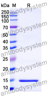 Anti-P.gingivalis PorM Nanobody (Nb01)