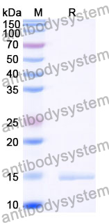 Anti-Porphyromonas gingivalis porM Nanobody (SAA0959)