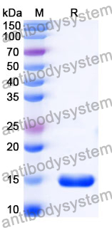 Anti-Porphyromonas gingivalis porM Nanobody (SAA1181)