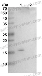 InVivoMAb Anti-Human GREM1/DAND2 Antibody (Iv0131)