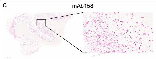 Immunohistochemistry for InVivoMAb Anti-Human APP/Amyloid beta Antibody (mAb158) ?>