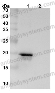 InVivoMAb Anti-Human SNCA Antibody (Iv0173)