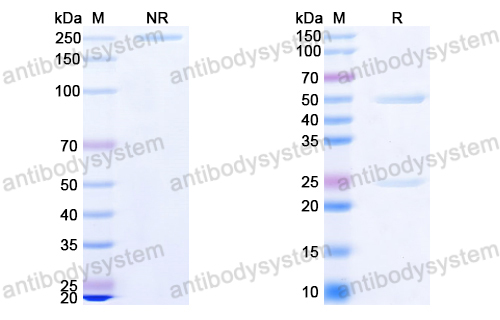 InVivoMAb Anti-HIV2 gp125 Antibody (7C8)