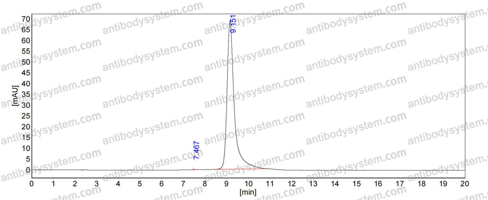 Anti-BKPyV Major capsid protein VP1 Antibody (Fs0394)