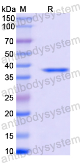 Recombinant Cat Fel d 1B/CH2 Protein, N-GST & C-His