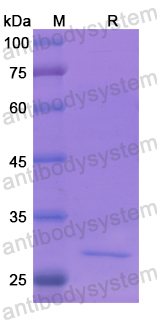 Recombinant Human LRP5L Protein, N-His