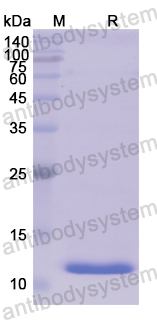 Recombinant Human CGB1 Protein, N-His