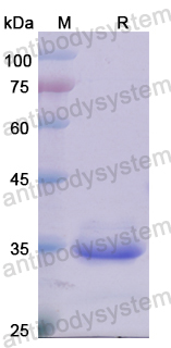 Recombinant Human YJEFN3 Protein, N-His