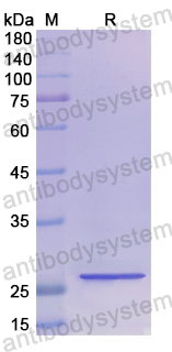 Recombinant Human A2ML1 Protein, N-His