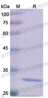 Recombinant Human MYO1G Protein, N-His