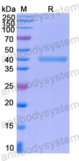 Recombinant Human KIF2A Protein, N-His
