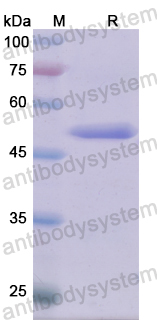 Recombinant Human SGK1 Protein, N-His