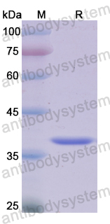 Recombinant Human PDLIM1 Protein, N-His