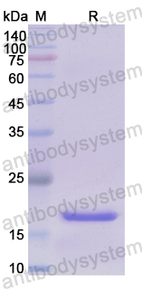 Recombinant Human LGALS9 Protein, N-His