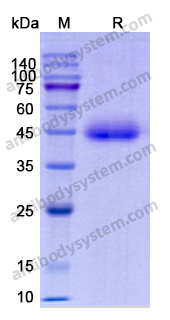 Recombinant Human MASP2 Protein, N-His