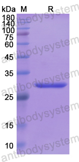 Recombinant Human AP3B1 Protein, N-His