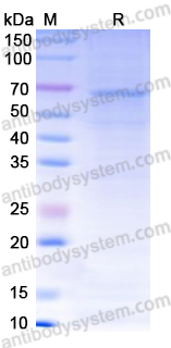 Recombinant Human CD284/TLR4 Protein, N-His