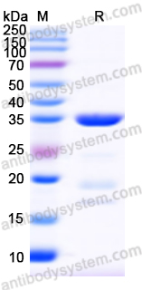 Recombinant Human LGALS8 Protein, N-His