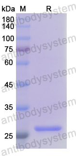 Recombinant Human NFKBIE Protein, N-His