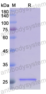 Recombinant Human PSMD9 Protein, N-His