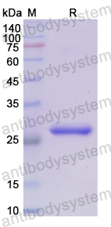 Recombinant Human SIRPB1 Protein, N-His