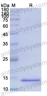 Recombinant Human AGRP Protein, N-His