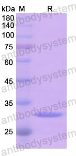 Recombinant Human DFFA Protein, N-His