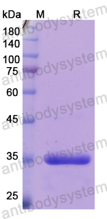 Recombinant Human WWP2 Protein, N-His