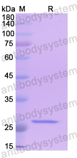 Recombinant Human CDC7 Protein, N-His