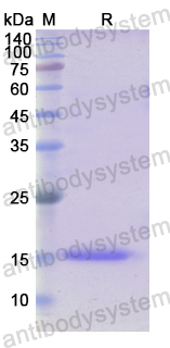 Recombinant Human UPK1A Protein, N-His