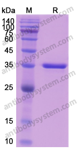 Recombinant Human ARNTL Protein, N-His