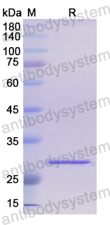 Recombinant Human PDHX Protein, N-His