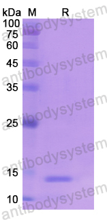 Recombinant Human SLC1A7 Protein, N-His