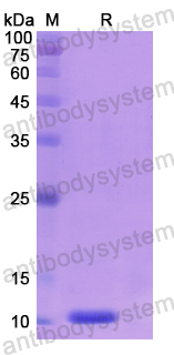 Recombinant Human SLC33A1 Protein, N-His