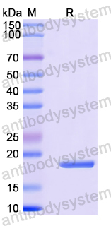 Recombinant Human PDE2A Protein, N-His
