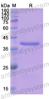 Recombinant Human IGF2BP3 Protein, N-His