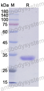 Recombinant Human PLK4 Protein, N-His