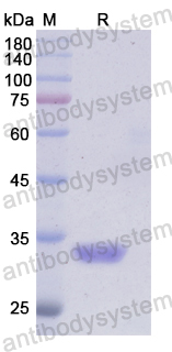 Recombinant Human TRAF5 Protein, N-His