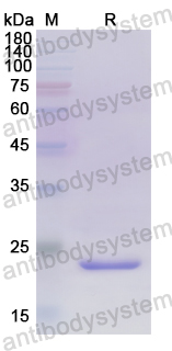 Recombinant Human AGRN Protein, N-His