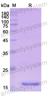 Recombinant Human MEIS1 Protein, N-His