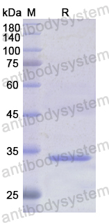 Recombinant Human BIN1 Protein, N-His