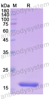 Recombinant Human UPK2 Protein, N-His