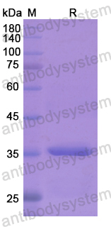 Recombinant Human CHL1 Protein, N-His