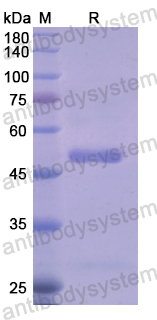 Recombinant Human PES1 Protein, N-His